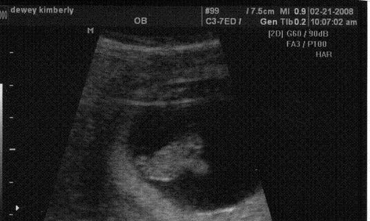 The first picture of our little 