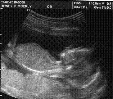 sono_baby